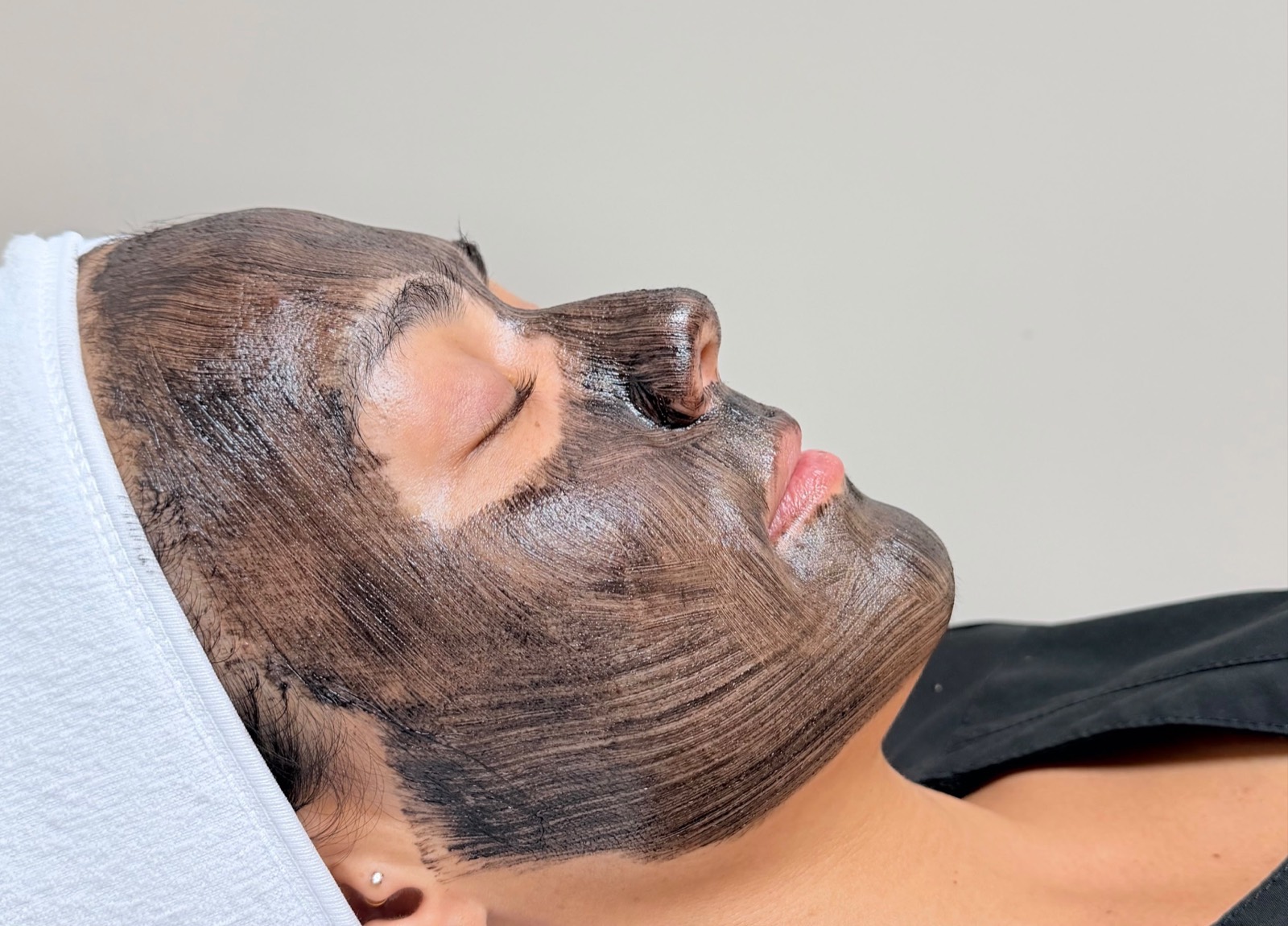 Estética Facial en PURAVÉ, Belén